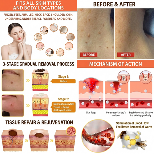 TagAway™ Removal Formula