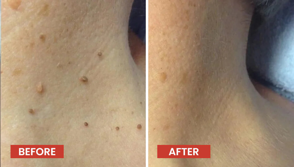 TagAway™ Removal Formula