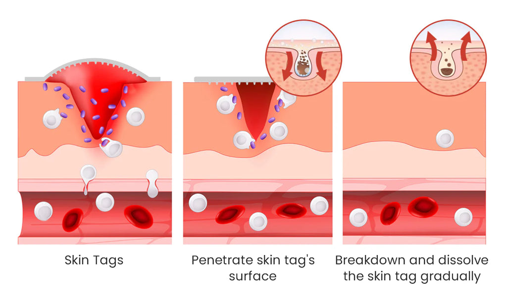 TagAway™ Removal Formula